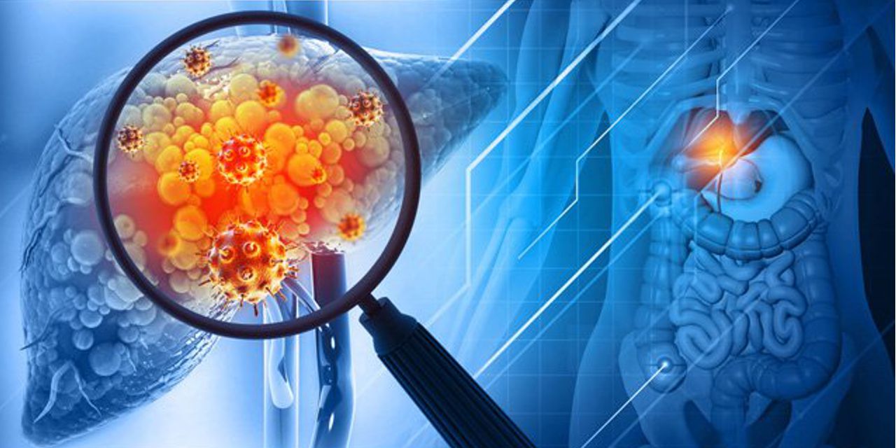 Сработать изнутри. Врач рассказала, как избавиться от жира вокруг печени