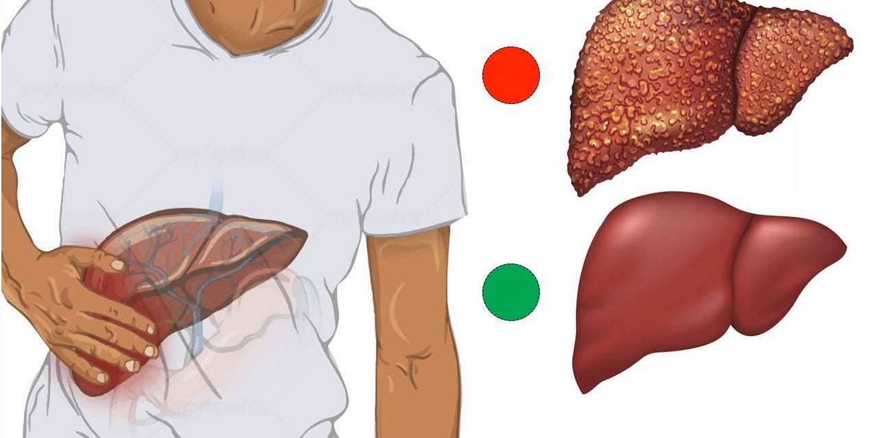  Способы восстановления печени после повреждения